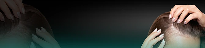 Hair Transplant for Women