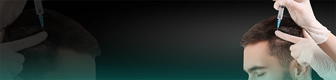 Hair Loss Injection Therapy