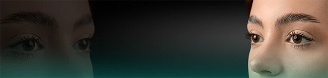 Eyebrow Transplantation